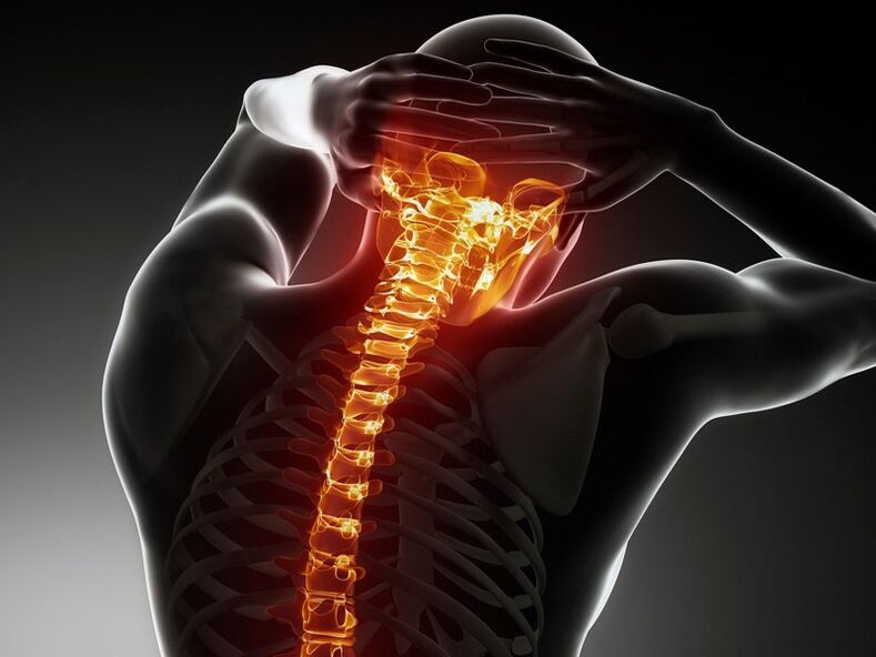 Nîşaneyên osteochondrosis