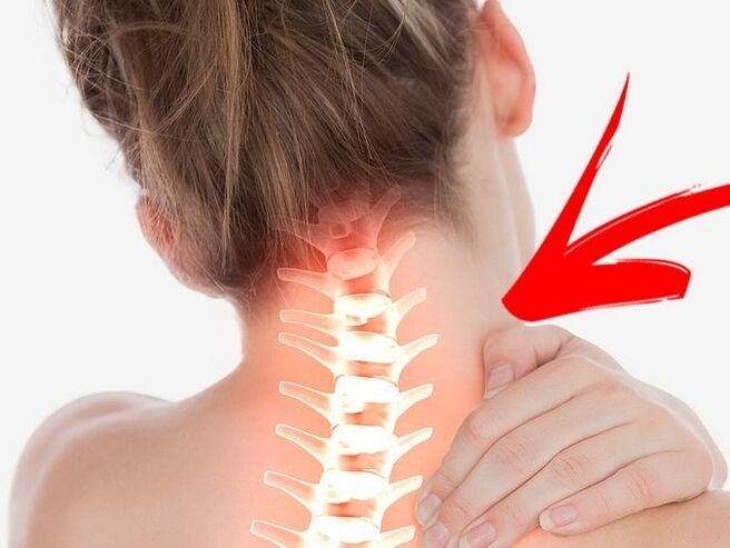 Compression of rûkên nervê bi osteochondrosis cervical