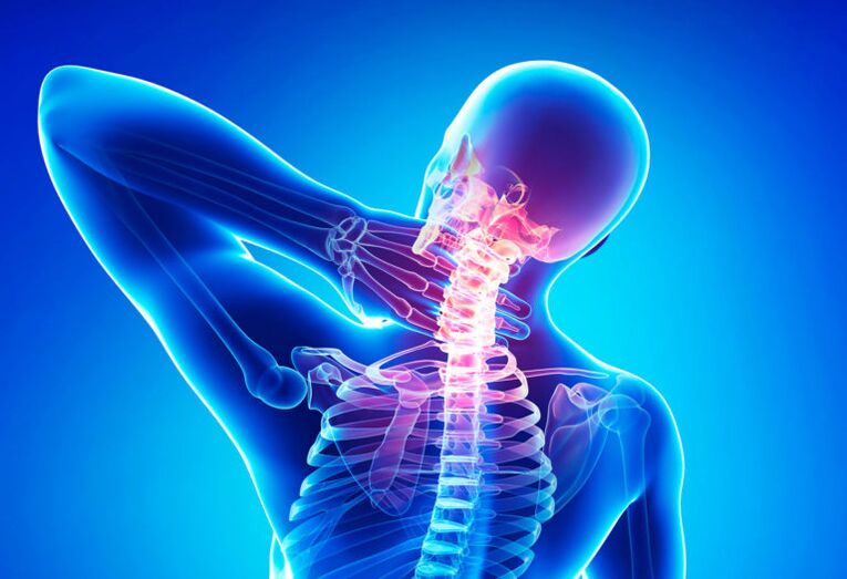 Osteochondrosis of Spine cervical