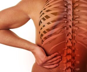 êşa piştê bi osteochondrosis lumbar