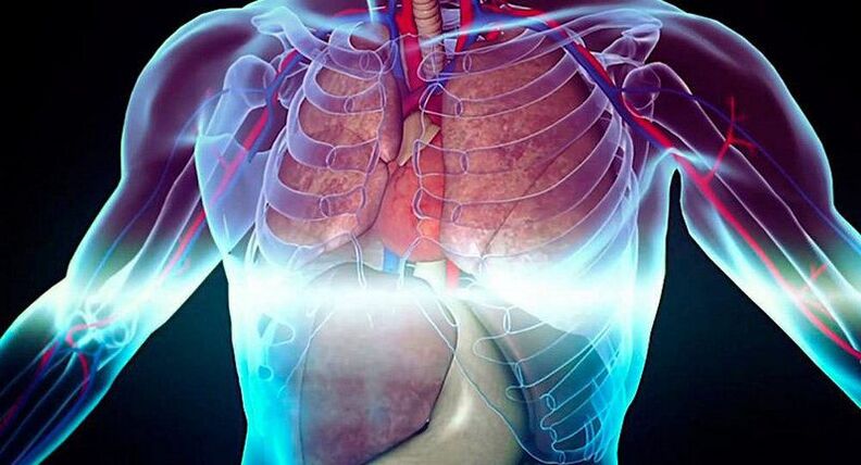 neuralgiya intercostal