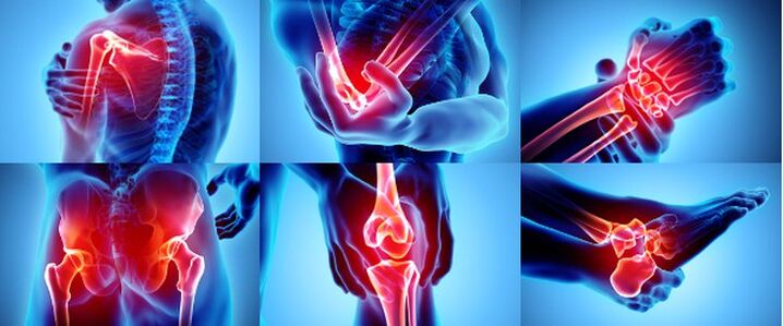 movikên iltîhab